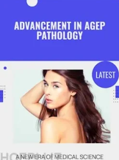 Advancement in AGEP Pathology