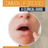 Common Lip Diseases: A Clinical Guide