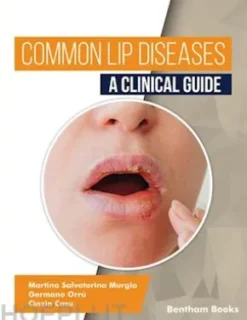 Common Lip Diseases: A Clinical Guide