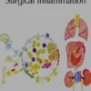 Surgical Inflammation