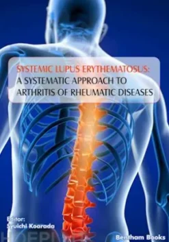 Systemic Lupus Erythematosus: A Systematic Approach to Arthritis of Rheumatic Diseases: Volume 4