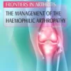 The Management of the Haemophilic Arthropathy